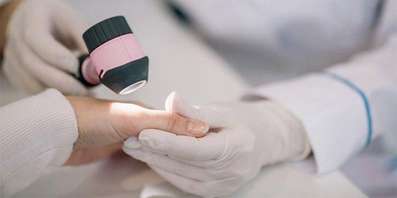 Getting Infected With Genital Warts Through Skin Contact